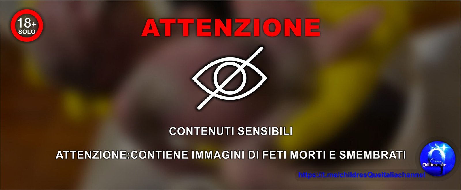 Attenzione - trovati 5 feti
